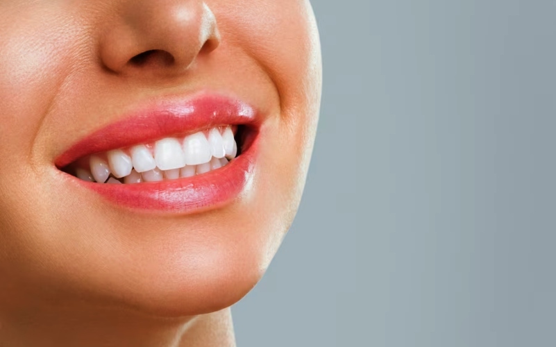 Paciente sorrindo com dentes mais brancos